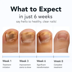 – Nail Repair Patches - Image 4