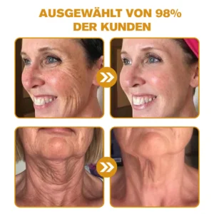 Botox Bienengift Faltenentfernungscreme - Image 11