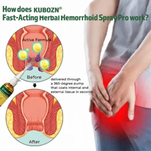 Fast-Acting Herbal Hemorrhoid Spray Pro - Image 4