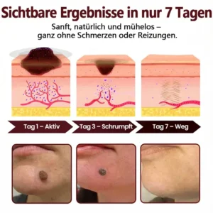 OryzaDarts TAG’GONE – Schmerzfreie Entfernung an der Wurzel dank Schwarzer-Reis-Mikrotechnologie ✨ - Image 8
