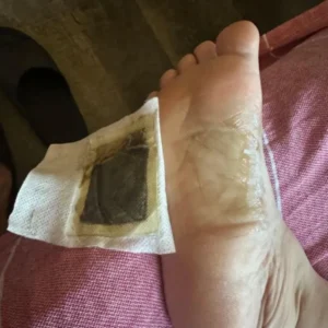 Detox Patches | Restore Balance & Wellness - Image 5