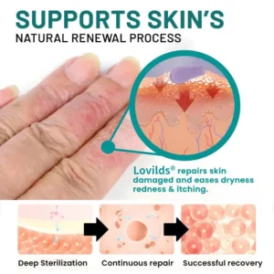 Probiotic + B 24-7 Moisture Eczema Relief Cream - Image 5