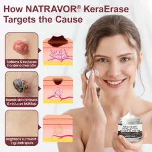 KeraErase Dual-Action Renewal Cream - Image 7