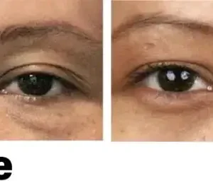 Nano Vision Repair Eye Serum - Image 12
