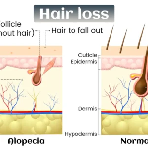 Biotin-Infused Hair & Beard Regrowth Atomizer -🔥7-Day Results - Image 7