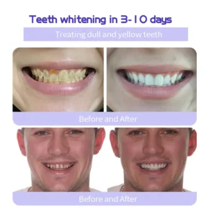 TeethRestoration Mineral Powder - Image 15