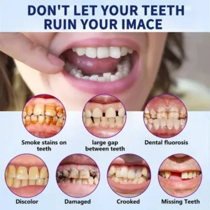Official Store | Advanced Full Denture Set 🦷 - Image 11