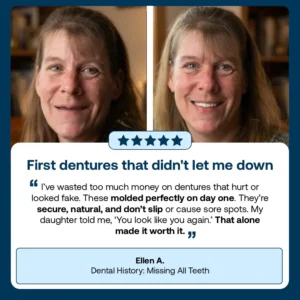 Full Denture with Strong Suctiond - Image 9