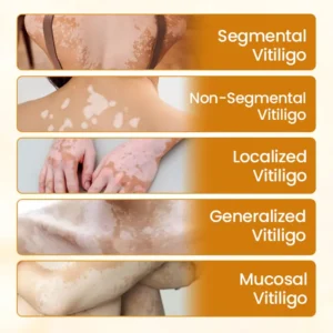 VitiClear Pro Bee Venom Cream - Image 9