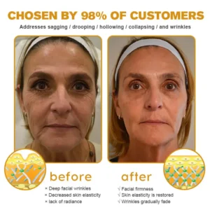 Botox Bee Venom Wrinkle Removal Cream - Image 9