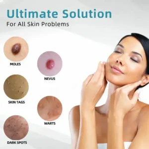 All-in-One CO₂ Laser Eraser Pen | Removes Moles, Warts, Skin Flaws & Pigmentation - Image 4