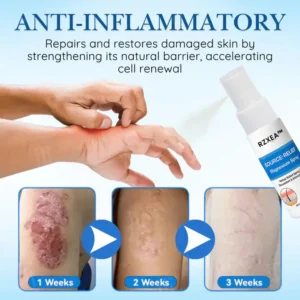 Source-Relief Magnesium Spray - Image 5