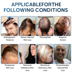 STEM Cell Hair Cycle Roller - Image 6