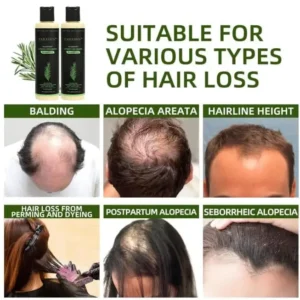 Rosemary Hydrolyzed Keratin Shampoo - Image 6