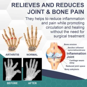 Bee Venom Pain and Bone Healing Cream - Image 4