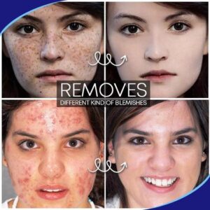 Pro.W Blemish Cream - Image 4