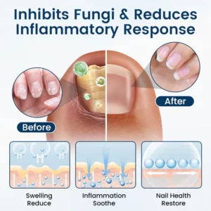 NailGuard Fungal Repair Herbal Spray - Image 10