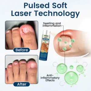 NailGuard Fungal Repair Herbal Spray - Image 8