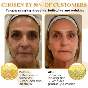 Letybo Bee Venom Wrinkle Removal Cream - Image 3