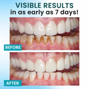 Oral Calculus Suppressant - Image 2