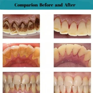 Oral Calculus Suppressant - Image 3