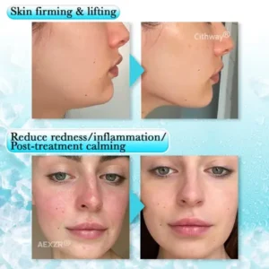 Anti-swelling Gel Beads Facial Therapy Mask - Image 7