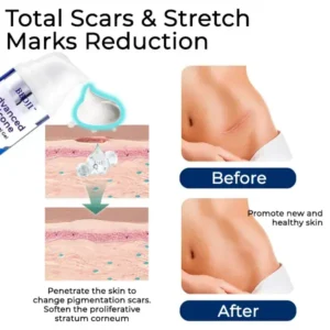 Advanced Silicone Scar Removal Gel - Image 4