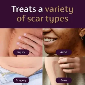 Advanced Scar Gel - Image 6