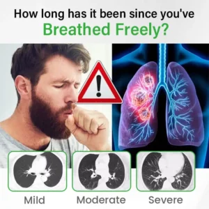 Breathe Easy Again Detox Inhaler Clears & Refreshes Your Lungs - Image 9