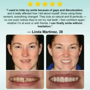𝗜𝗻𝘀𝘁𝗮𝗻𝘁 𝗦𝘁𝗶𝗰𝗸-𝗼𝗻 𝗗𝗲𝗻𝘁𝗮𝗹 𝗩𝗲𝗻𝗲𝗲𝗿𝘀 (✅Clinically proven, easy-to-use dental veneers trusted by over 8,000 US users for a comfortable, natural smile.) - Image 4