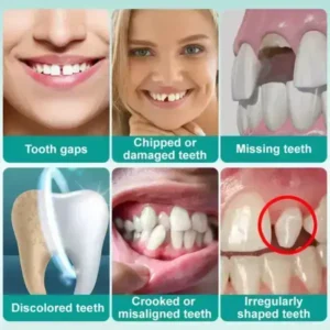 𝗜𝗻𝘀𝘁𝗮𝗻𝘁 𝗦𝘁𝗶𝗰𝗸-𝗼𝗻 𝗗𝗲𝗻𝘁𝗮𝗹 𝗩𝗲𝗻𝗲𝗲𝗿𝘀 (✅Clinically proven, easy-to-use dental veneers trusted by over 8,000 US users for a comfortable, natural smile.) - Image 7