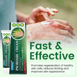 Knotaway Psoriasis Cream - Image 9