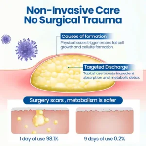 Lipoma Removal Cream - Image 7