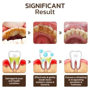 Niacinamide Intensive Whitening Toothpaste - Image 7
