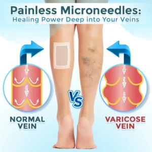 VenaRestore MicroNeedle Vein Repair Patch - Image 5
