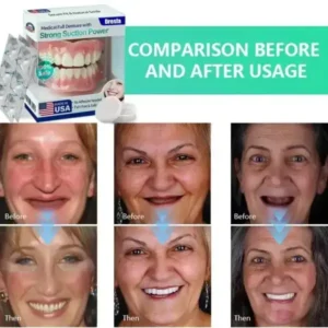 Full Denture with Strong Suction - Image 3