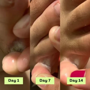 AntiFungal Relief Soap Bar - Image 5