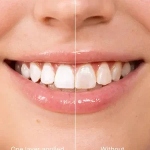 Teeth whitening - Instant Whitening for a Sparkling Smile - Image 5