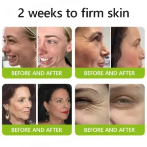 Botox & Retinol Shot - Image 14