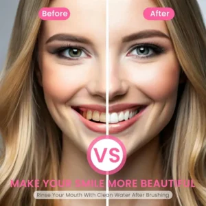 🏆【Max】 Nicotinamide Toothpaste【💎New upgrade Powerful type 10% concentration of Nicotinamide】 - Image 6
