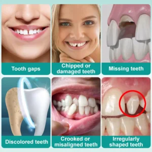 Instant Stick-on Dental Veneers (✅Clinically proven, easy-to-use dental veneers trusted by over 8,000 US users for a comfortable, natural smile.) - Image 6