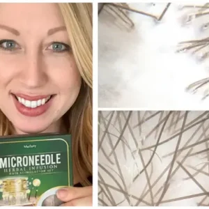 Microneedle Herbal Infusion Hair Stimulation Set - Image 7