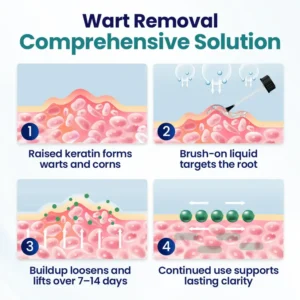 WartLift Corn Removal Liquid - Image 5
