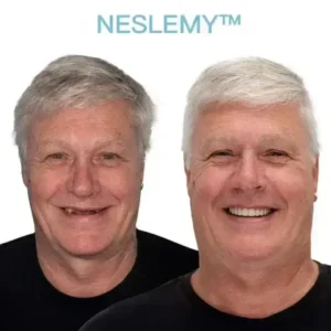 GelFit Dentures - Image 2