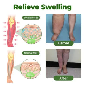 FluidEase Leg Therapy Edema Cream - Image 7