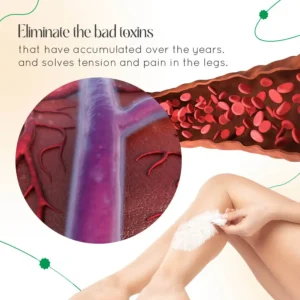 Vein Therapy Cream - Image 5