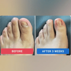 – Nail Repair Patches - Image 7