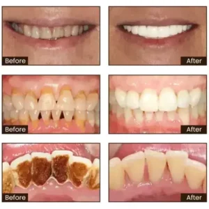 Niacinamide Whitening Toothpaste - Image 14
