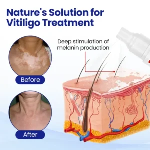 VitiClear Herbal Spray - Image 7