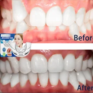 Mandibular Corrector-For a Healthier, More Aligned Smile🦷🔥 - Image 11